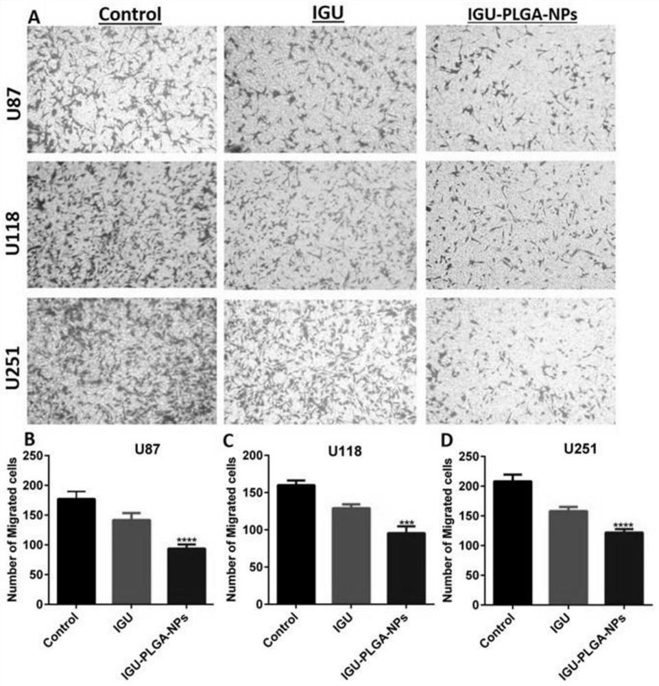 Igu-plga-nps nanoparticle and its preparation method and application