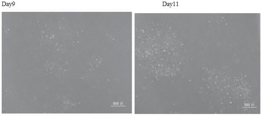 In-vitro separation and cultivation method for tooth-sourced mesenchymal stem cells