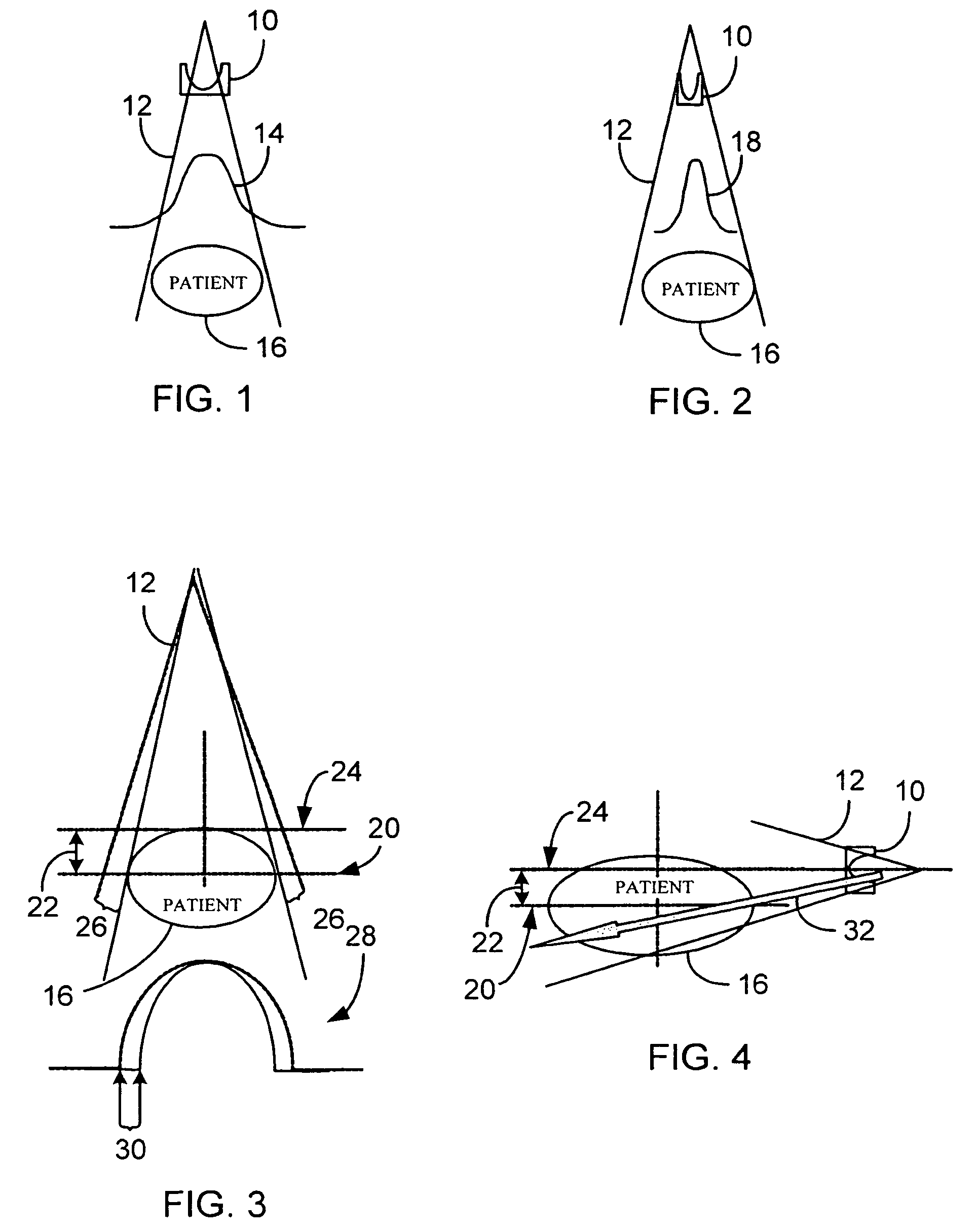 System and method of x-ray flux management control