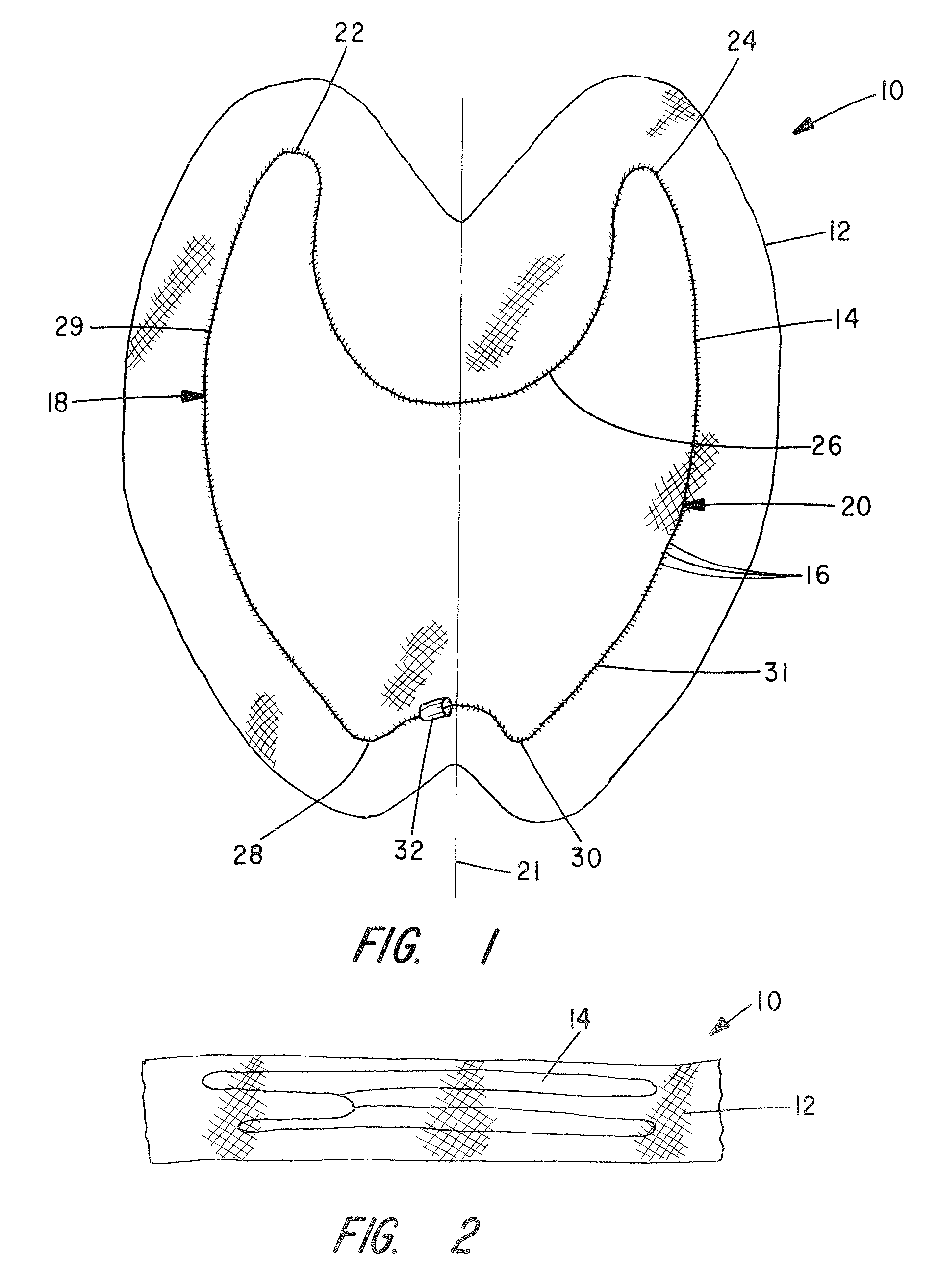 Apparatus and method for pelvic floor repair in the human female