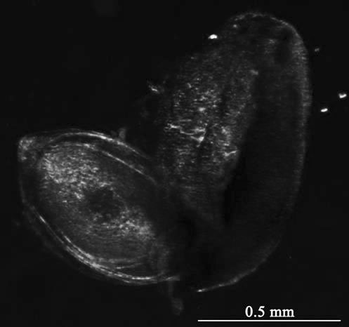 Method for transgenosis of ovules in ovaries of young pomegranate fruits by using agrobacterium injection technology and application of method