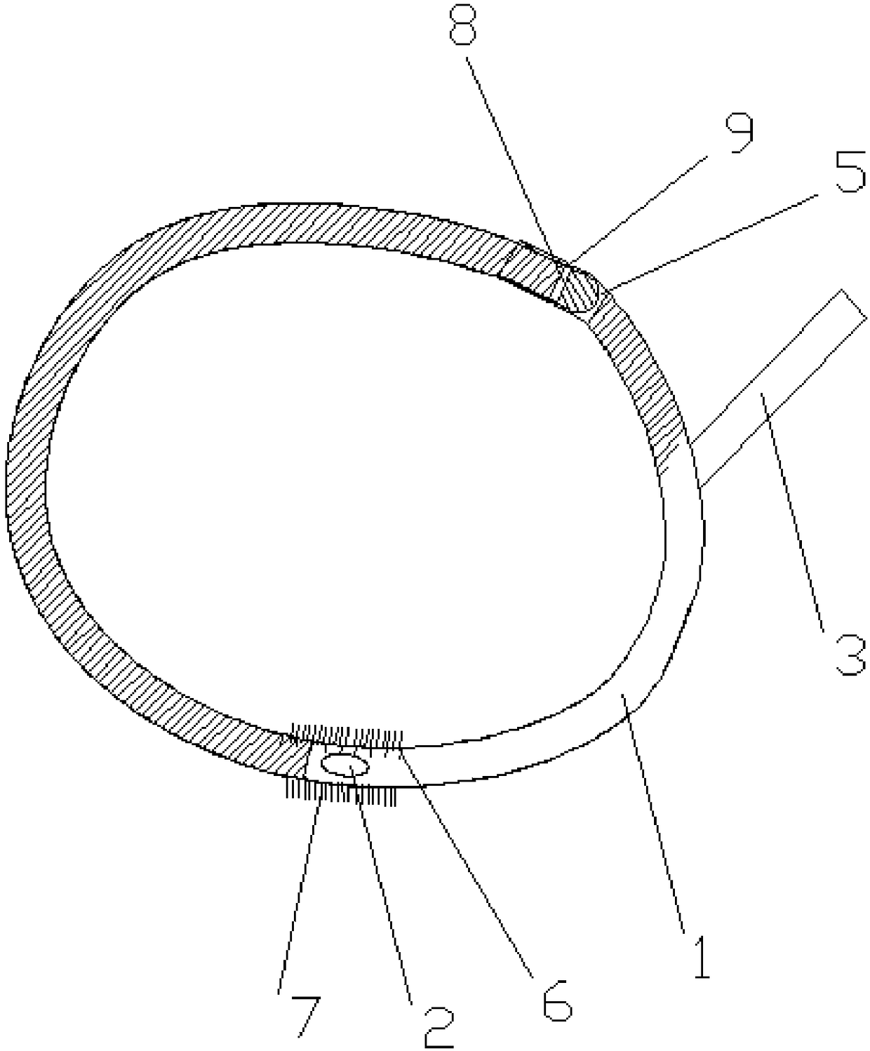 Anal fistula flushing floating thread