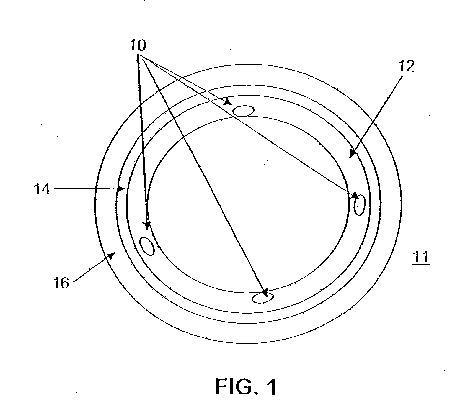 Bioactive stents for type ii diabetics and methods for use thereof