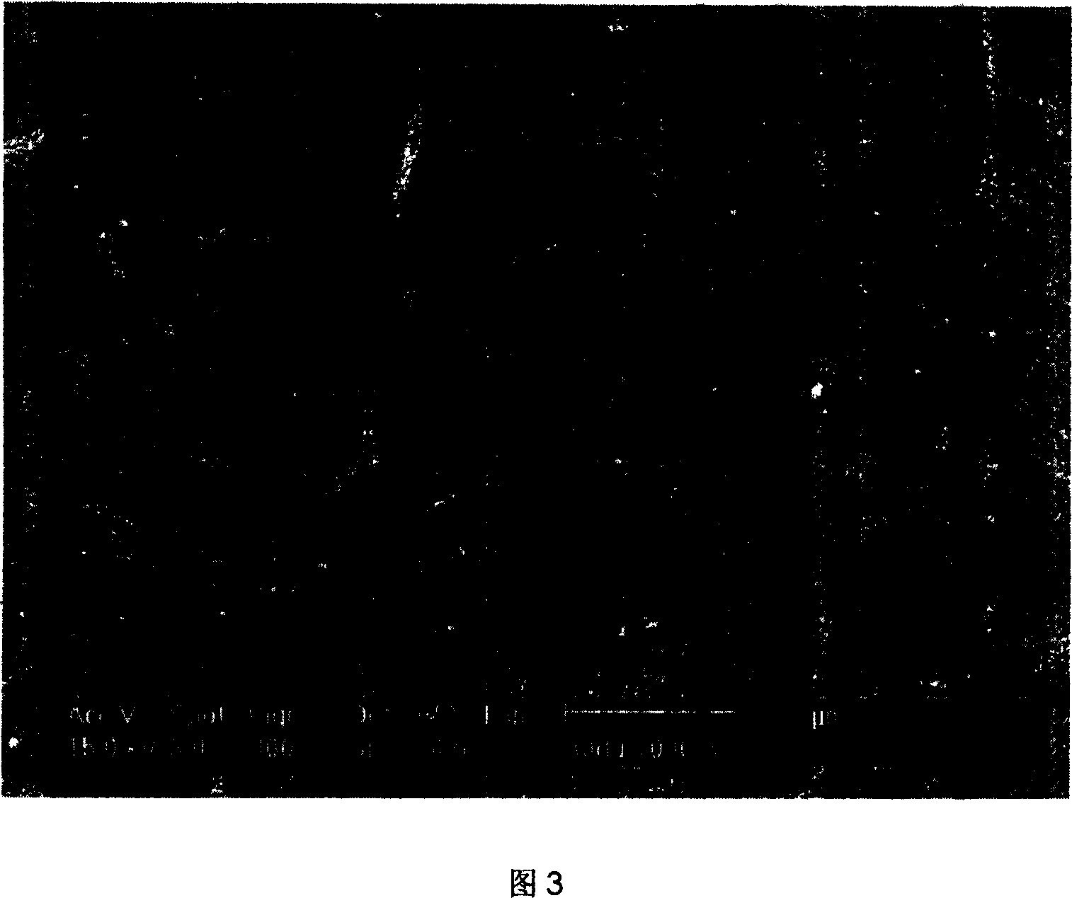 Chromium-free treating liquid for preparing erosion-resisting oxide film on aluminum alloy surface, treating and using method thereof