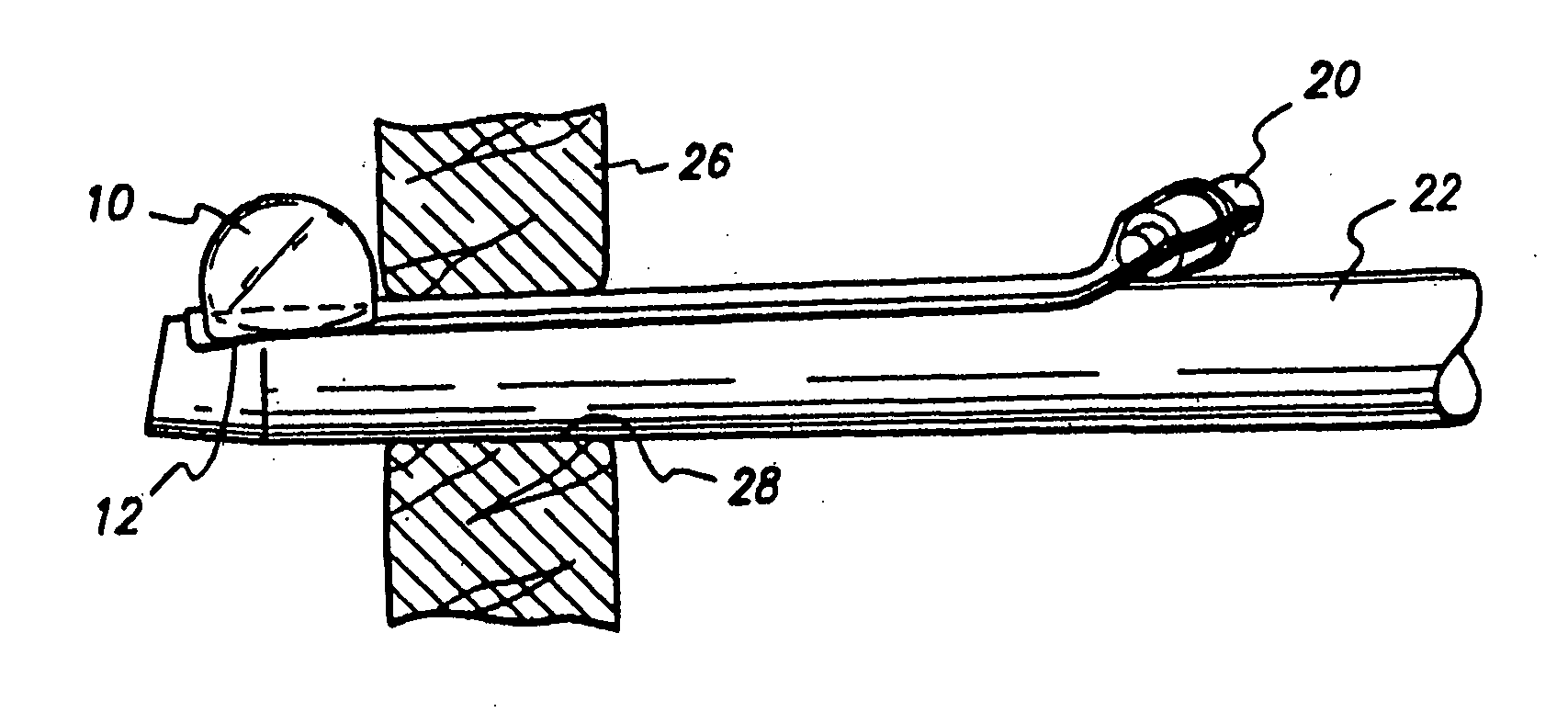 Method and apparatus for anchoring laparoscopic instruments