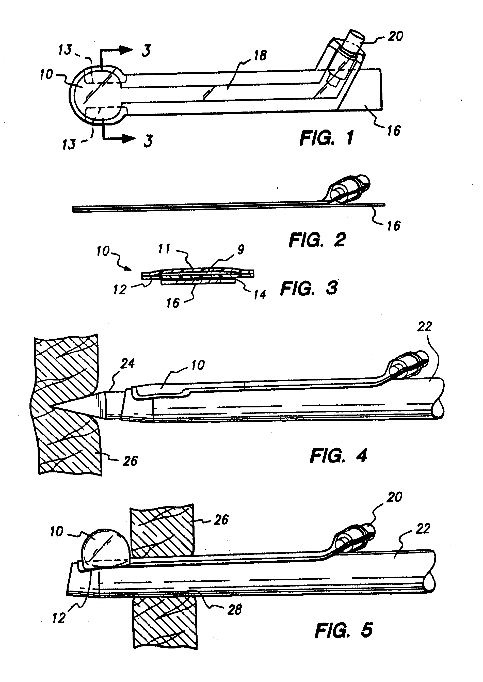 Method and apparatus for anchoring laparoscopic instruments