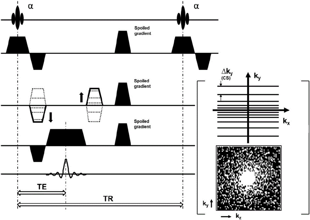 Abdominal organ dynamic contrast enhanced magnetic resonance imaging method based on compressed sensing
