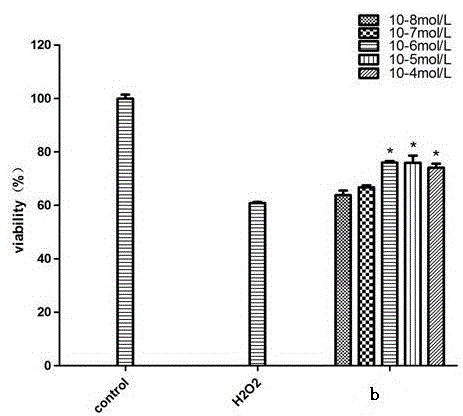 Novel compound extracted from nardostachys chinensis as well as preparation method and application thereof