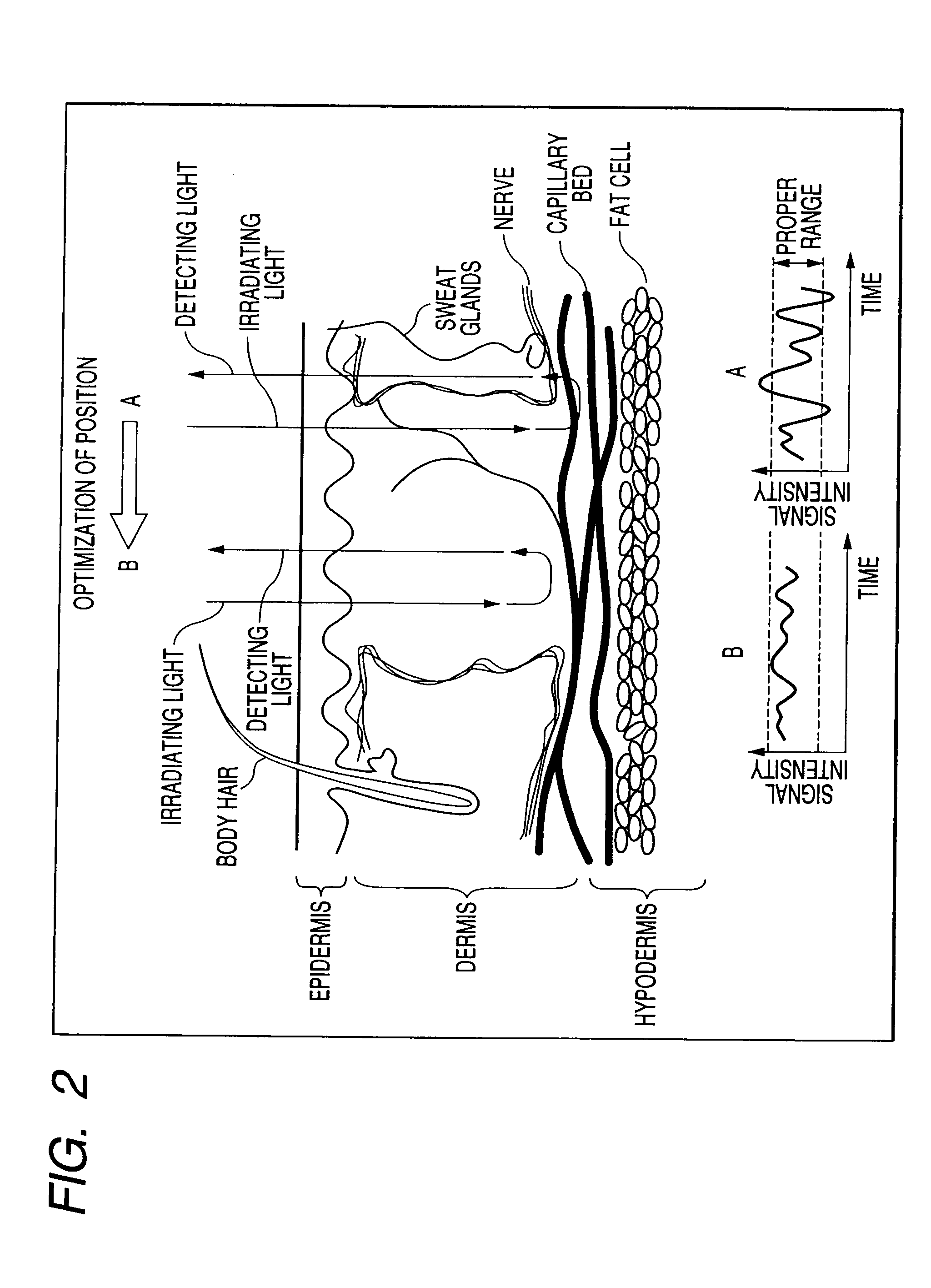 Living body information measuring apparatus