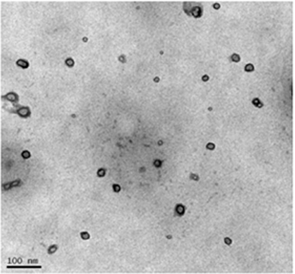 Use of strychnine immune nanoparticles for preparing anti-liver cancer targeted drugs