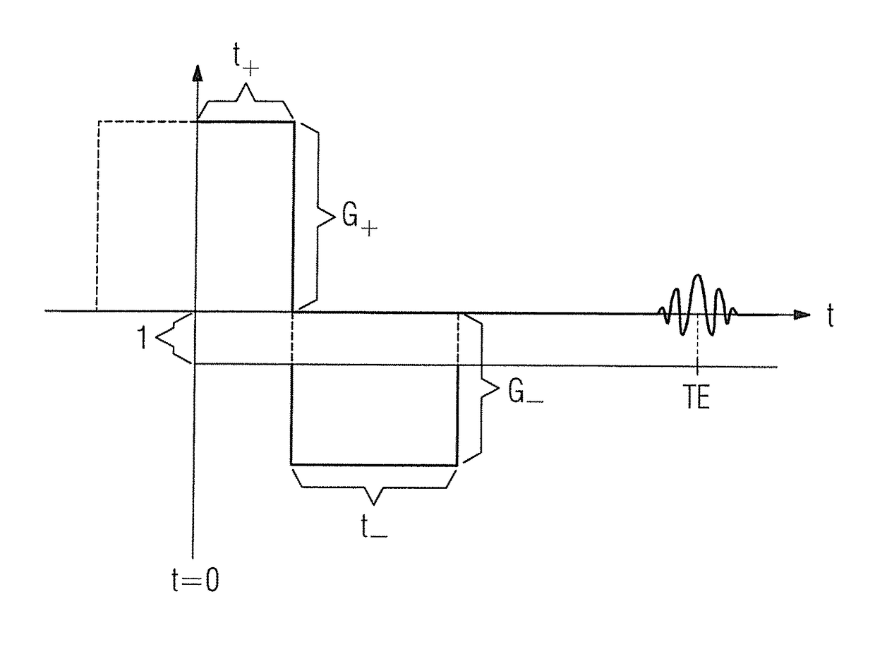 Method and apparatus for recording a magnetic resonance data set