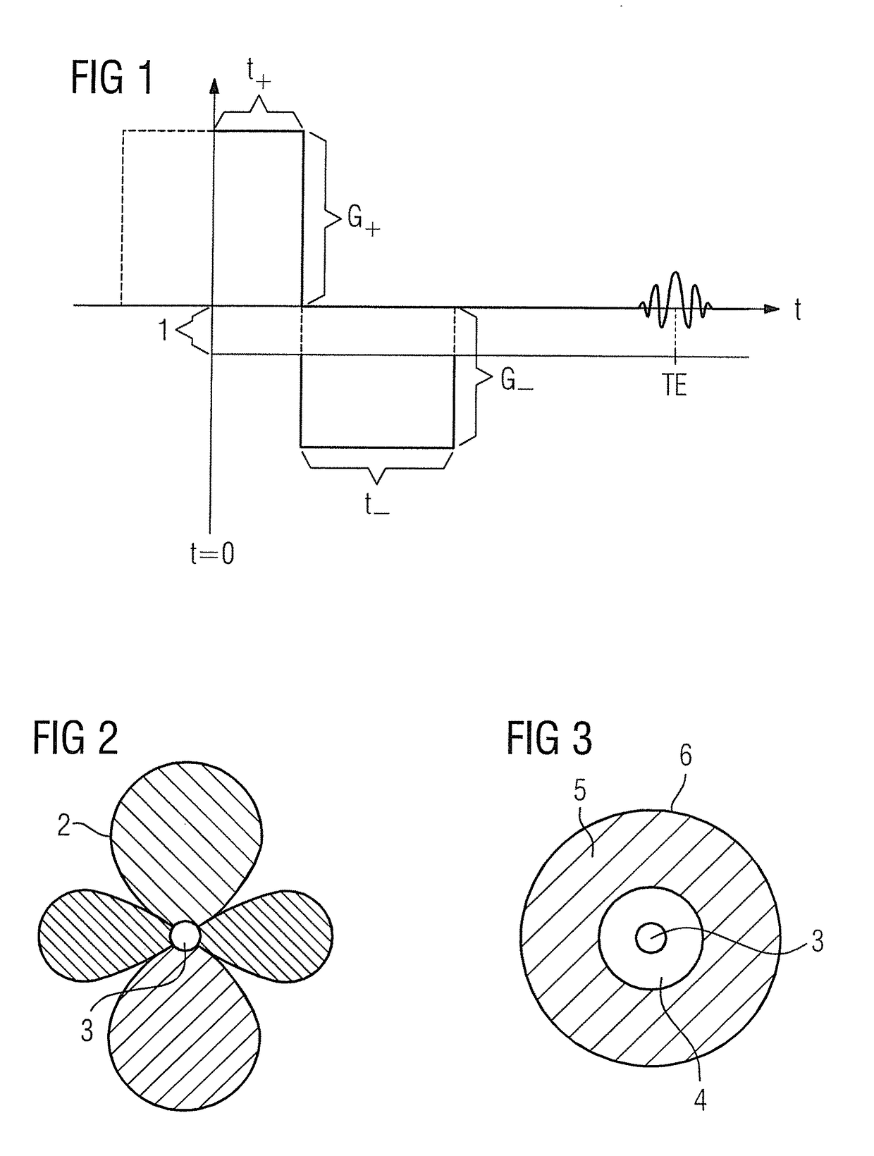 Method and apparatus for recording a magnetic resonance data set