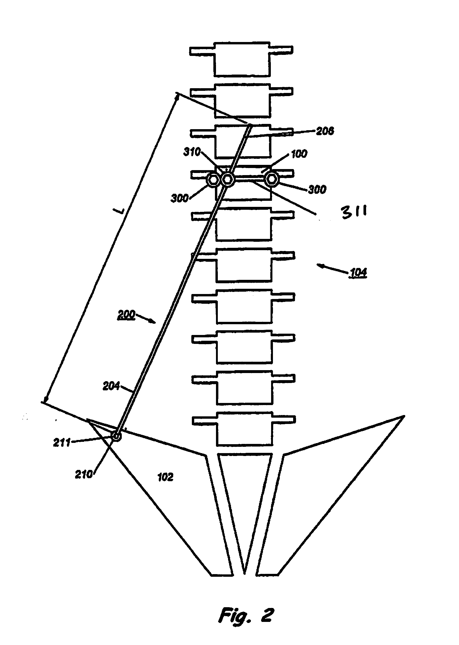 Device and Method for Treatment of Spinal Deformity