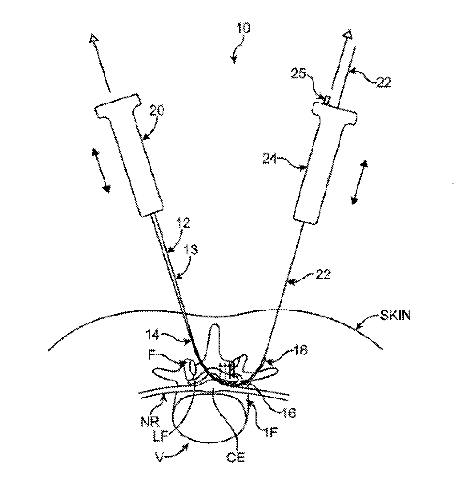 Access and tissue modification systems and methods