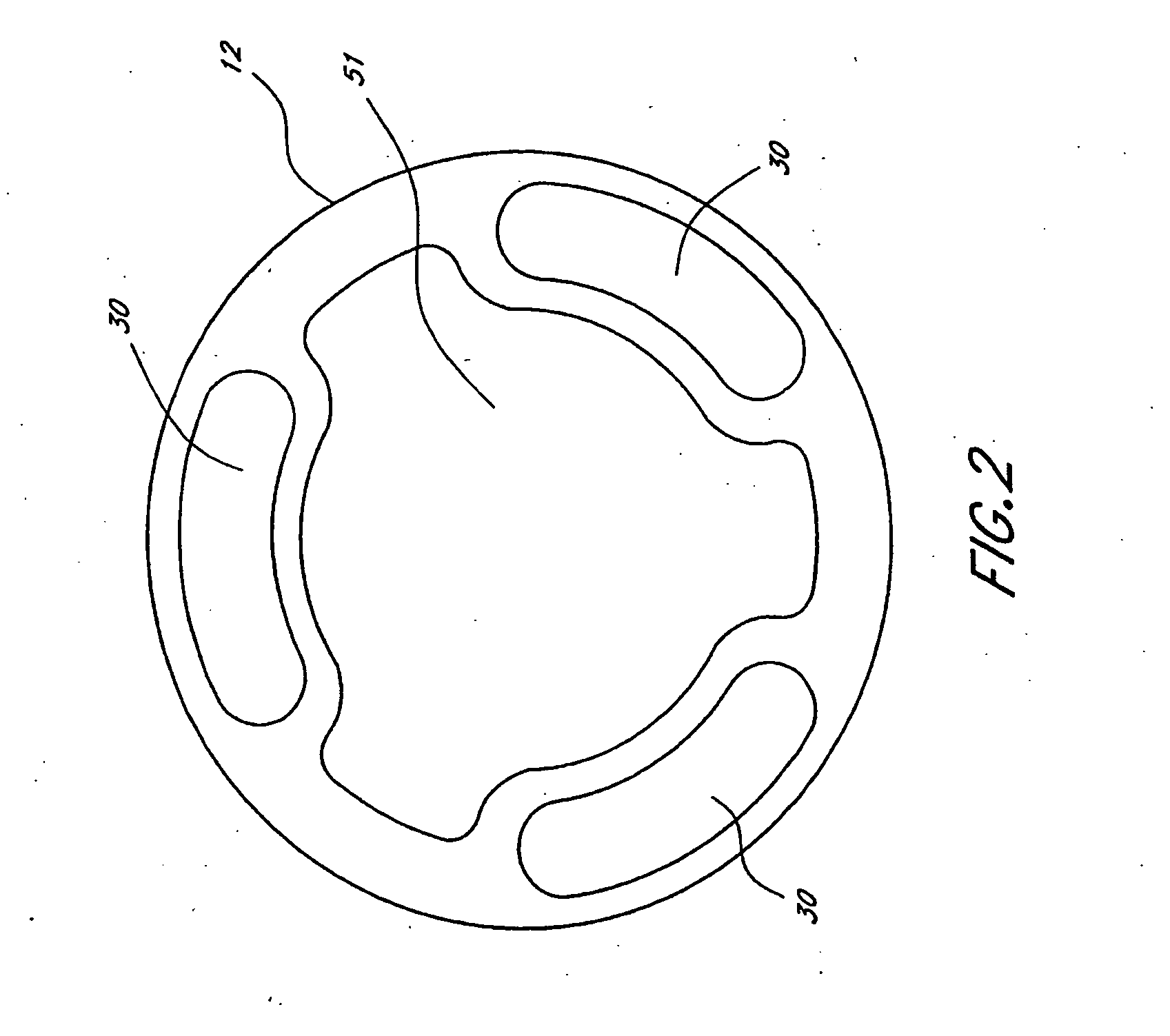 Catheter with ultrasound-controllable porous membrane