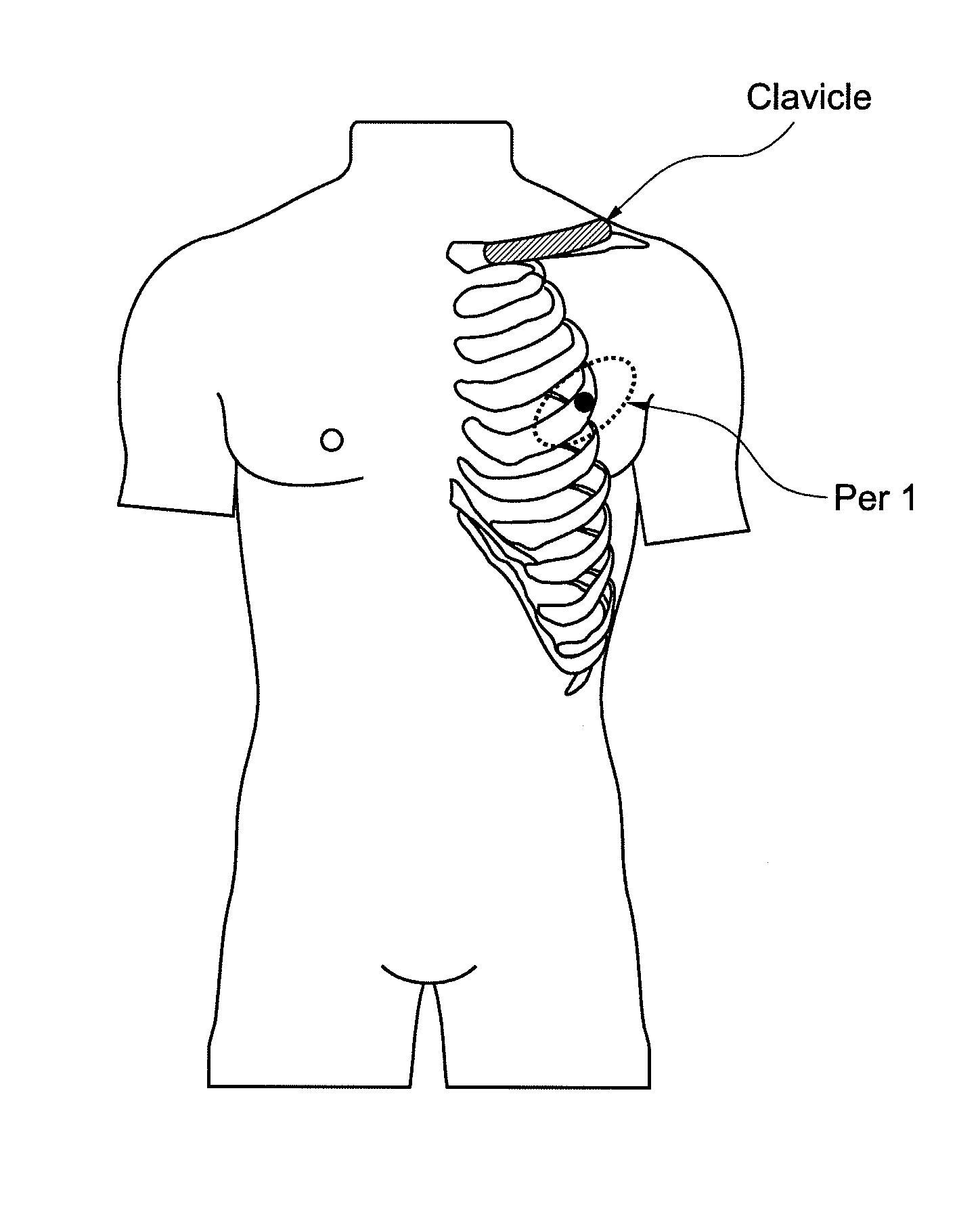 Evaluation of sympathetic tone