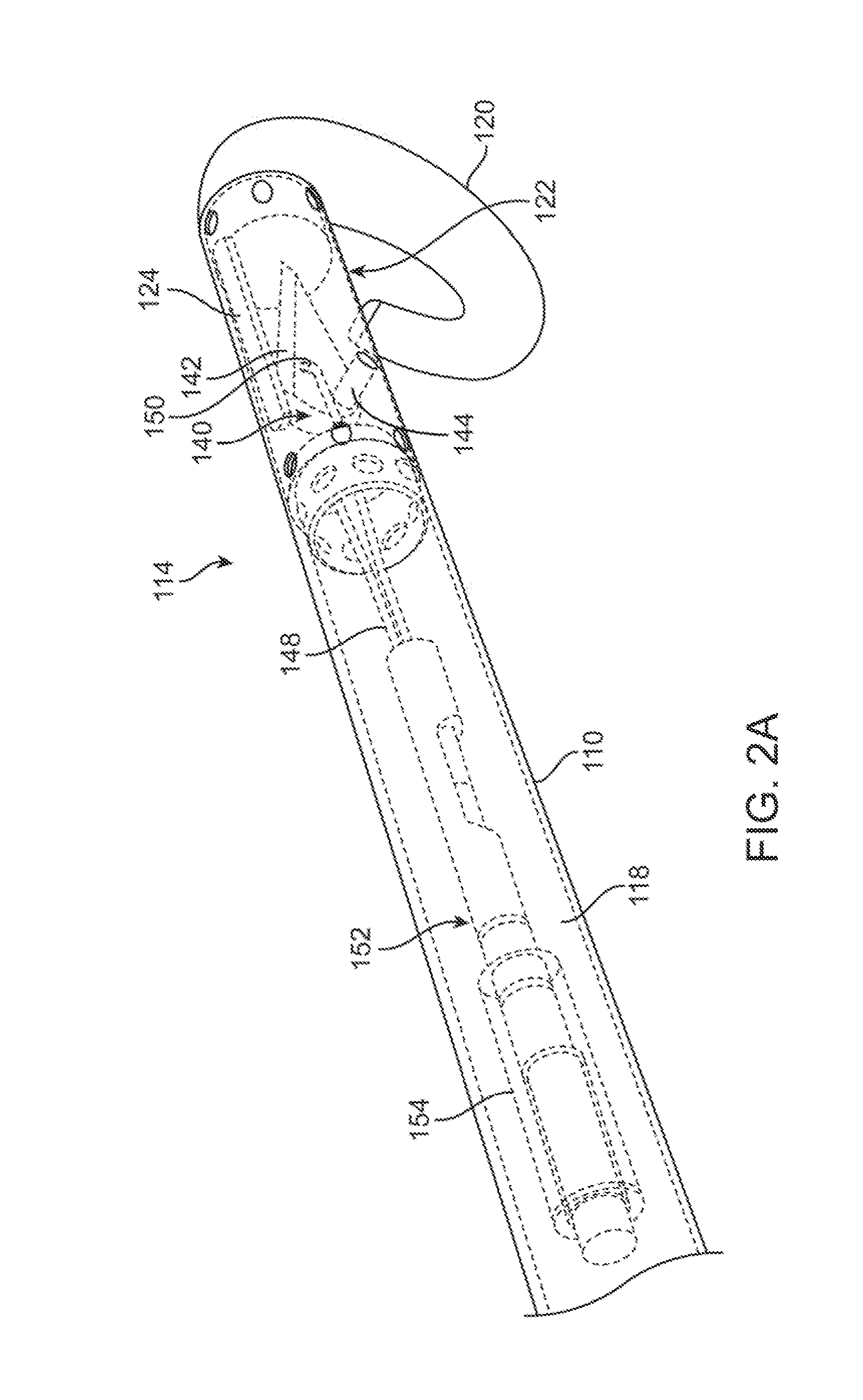 Methods and devices for diastolic assist