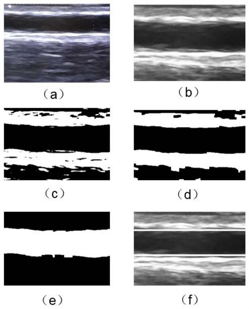 Ultrasonic-image-based puncture needle tip and vascular wall depth localization method