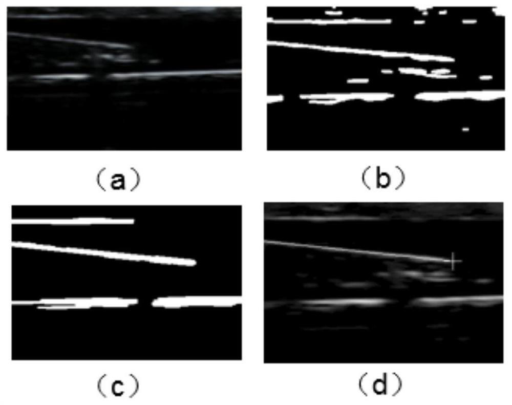 Ultrasonic-image-based puncture needle tip and vascular wall depth localization method