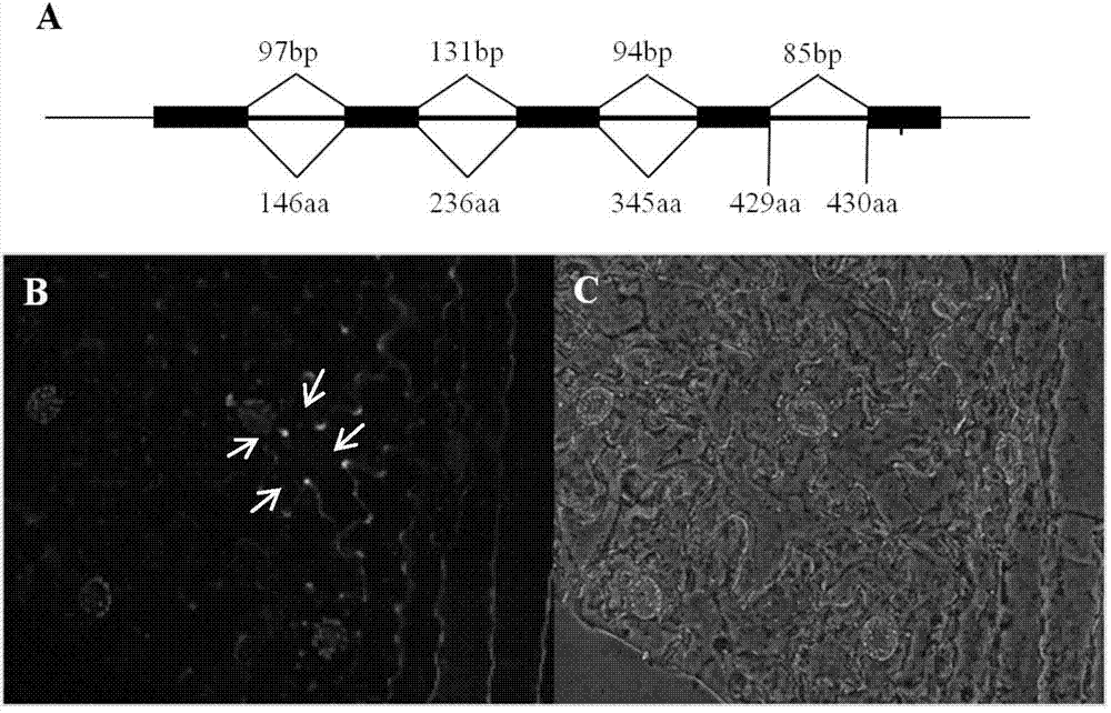 Cloning and identification of GhDUF231L1 gene related with cotton fiber development