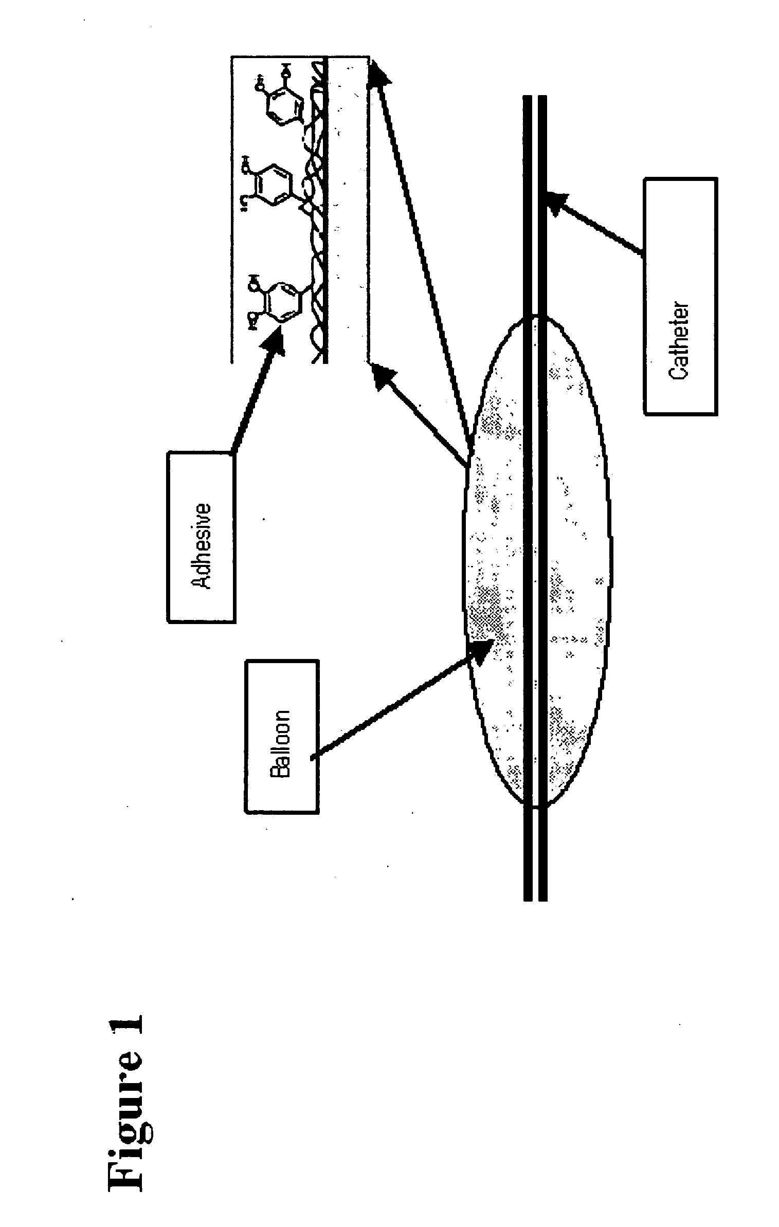 Sticky dilatation balloon and methods of using