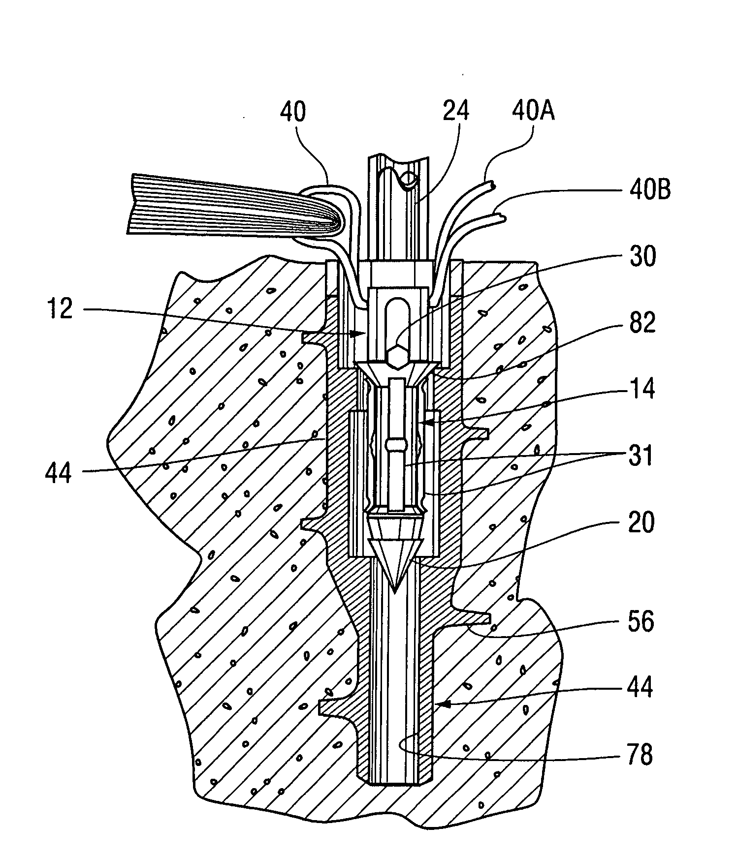 Knotless suture anchor and receptacle combination