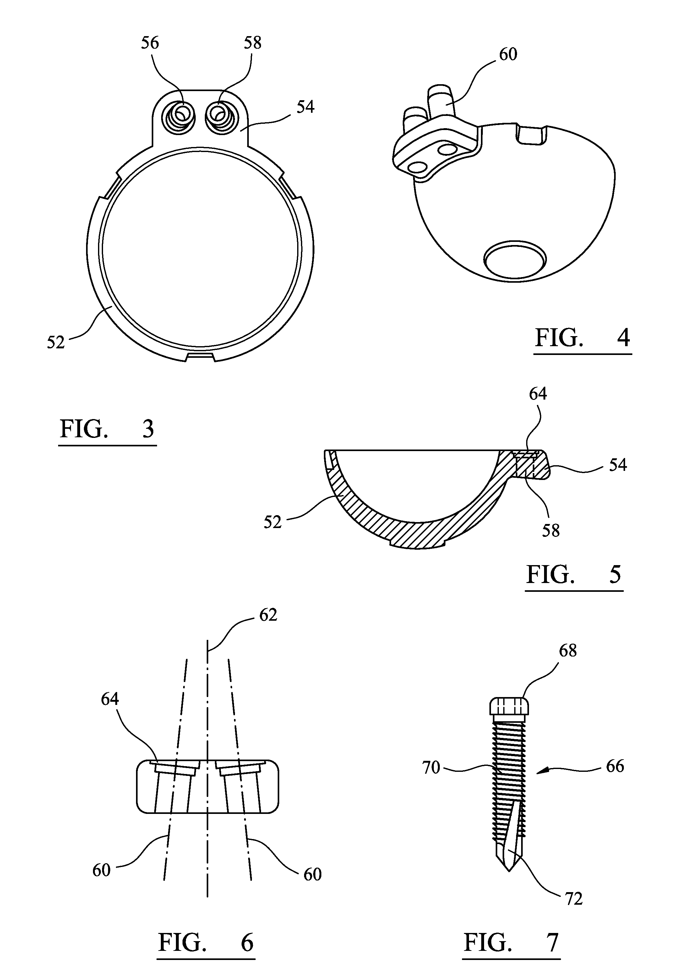 Cup component of an orthopaedic joint prosthesis