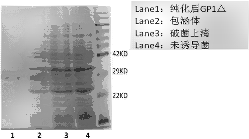 Antigen fragment and truncated protamine based on Marburg virus envelope protein and application