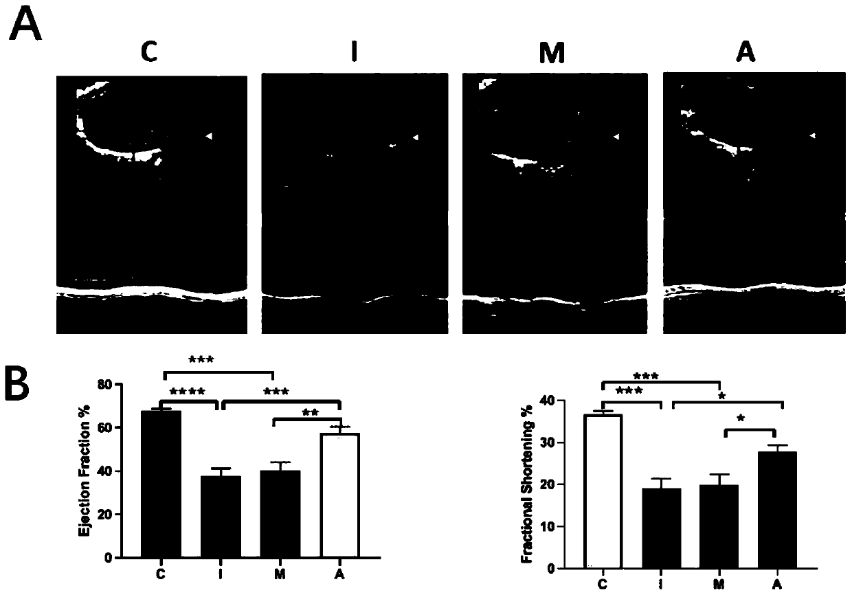 Acetaldehyde dehydrogenase 2 (ALDH2) activated mitochondria preparation for treating myocardial ischemia reperfusion injury, and preparation method and application thereof