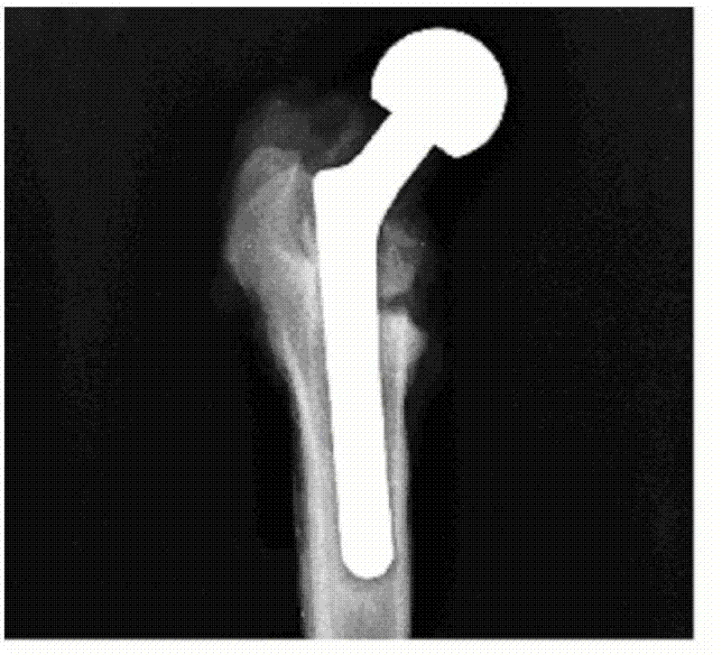 Method for strengthening joint stability by using rhBMP-2 release coating on surface of artificial joint