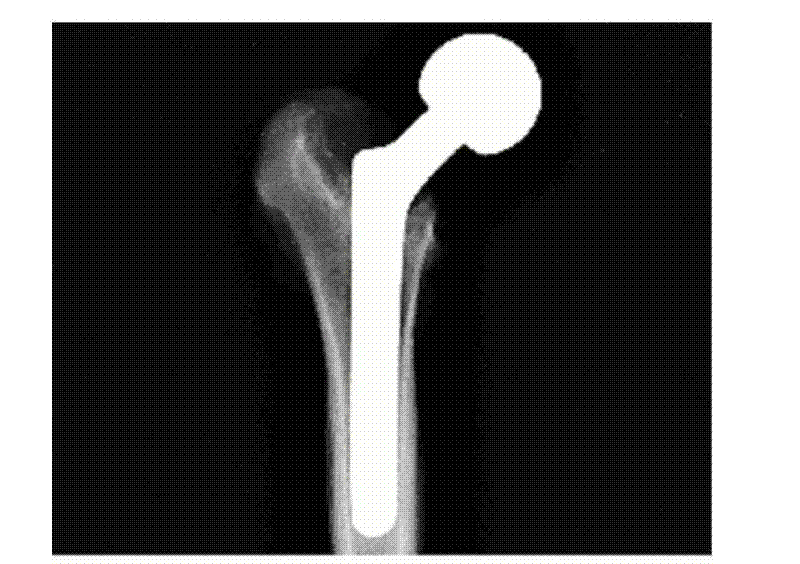 Method for strengthening joint stability by using rhBMP-2 release coating on surface of artificial joint