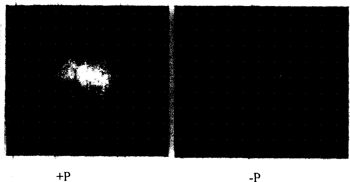 Rice root system phosphorus starvation induction specific expression promoter and its plant culture method