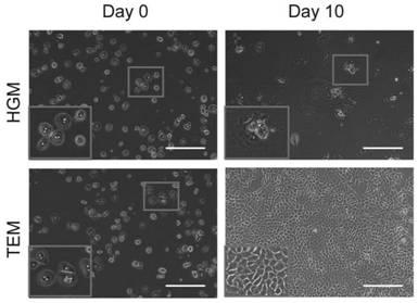 Liver precursor-like cell model derived from primary hepatocyte for hepatitis B virus infection, preparation method and application