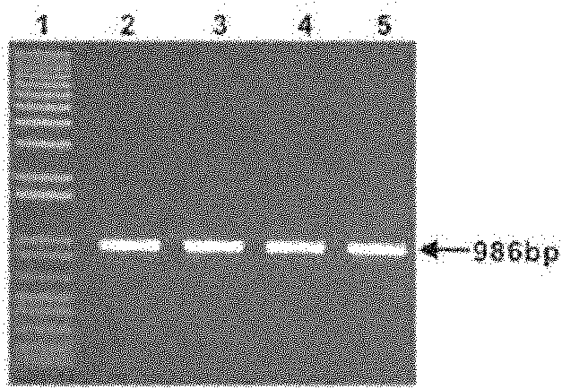 Method for improving yield of Streptomyces antibiotics and plasmid thereof