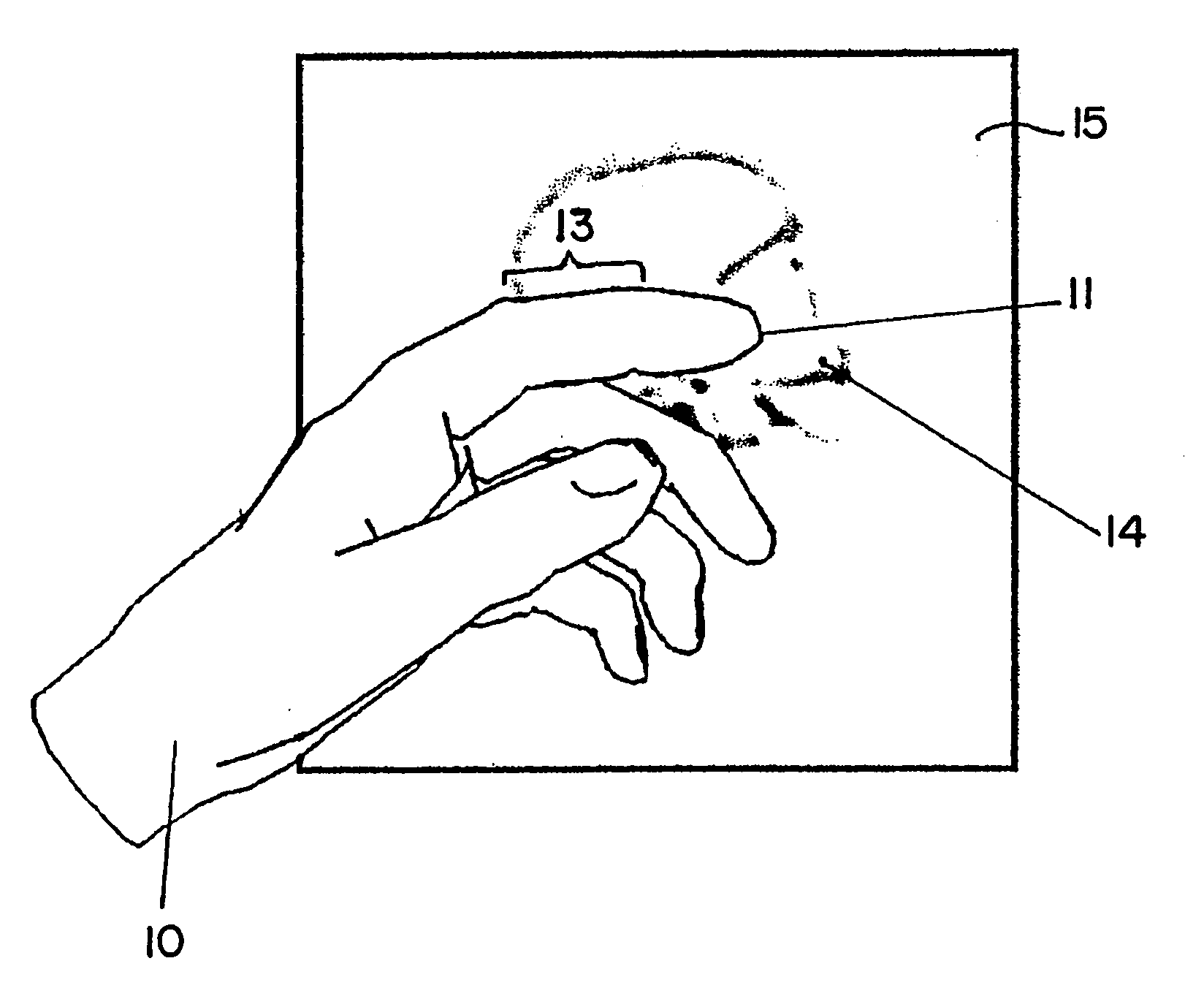 Method for displaying and/or processing image data of medical origin using gesture recognition