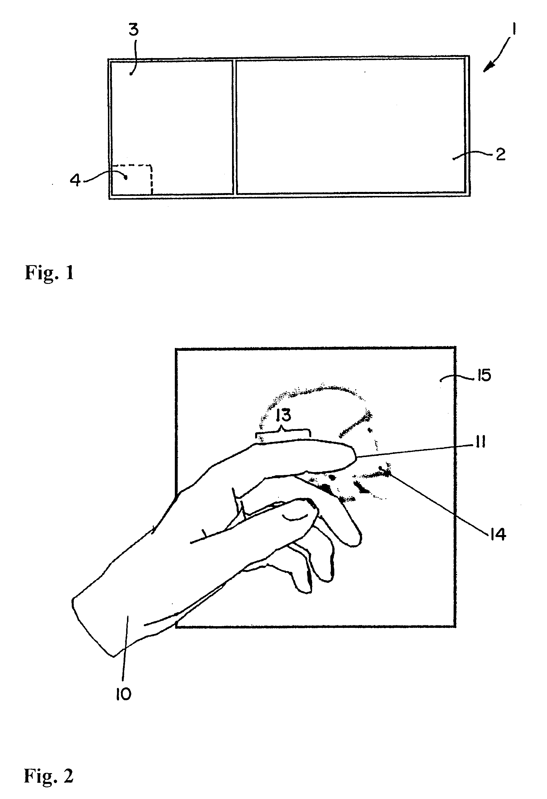 Method for displaying and/or processing image data of medical origin using gesture recognition
