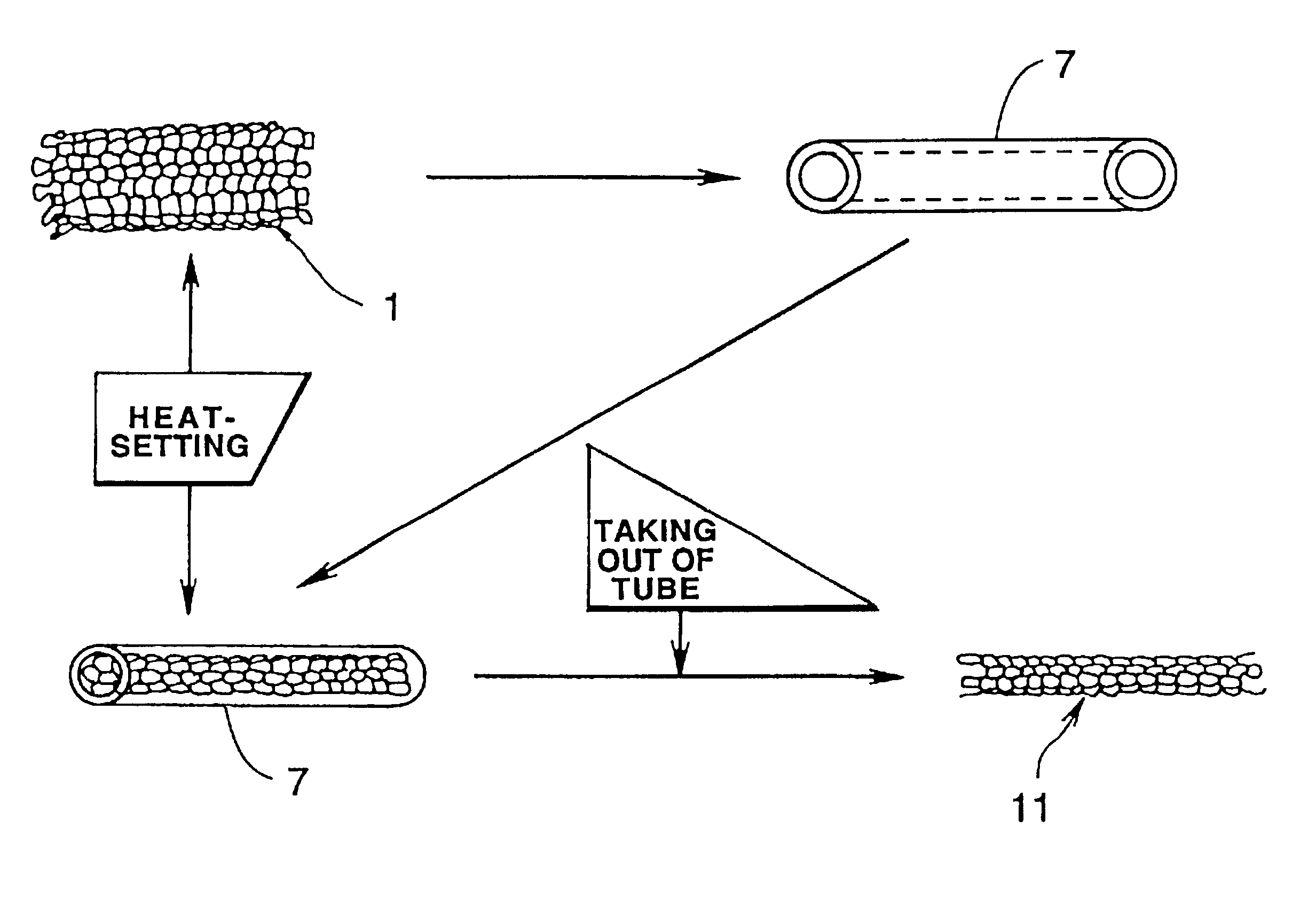 Luminal stent, holding structure therefor and device for attaching luminal stent