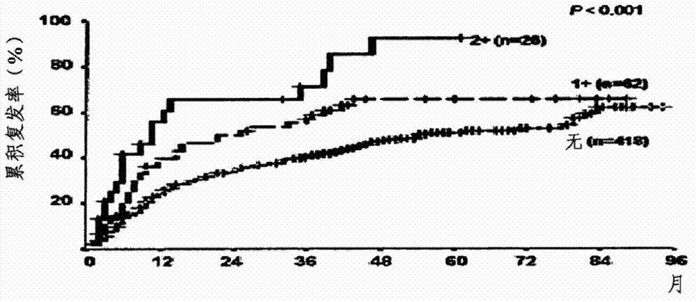 Single nucleotide polymorphism for prognosis of hepatocellular carcinoma