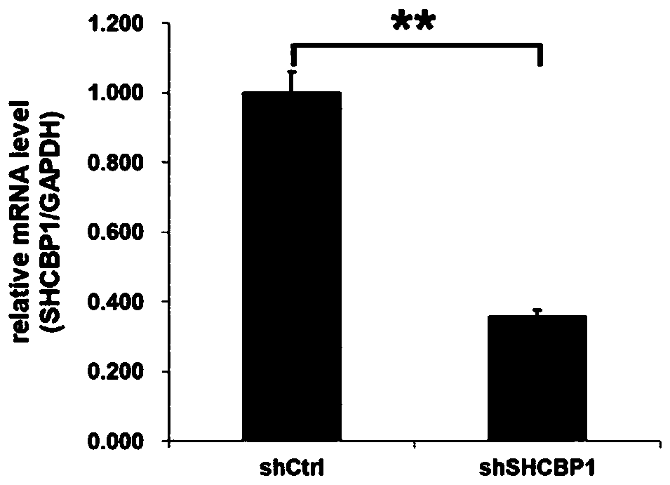 Application of human SHCBP1 gene and related product
