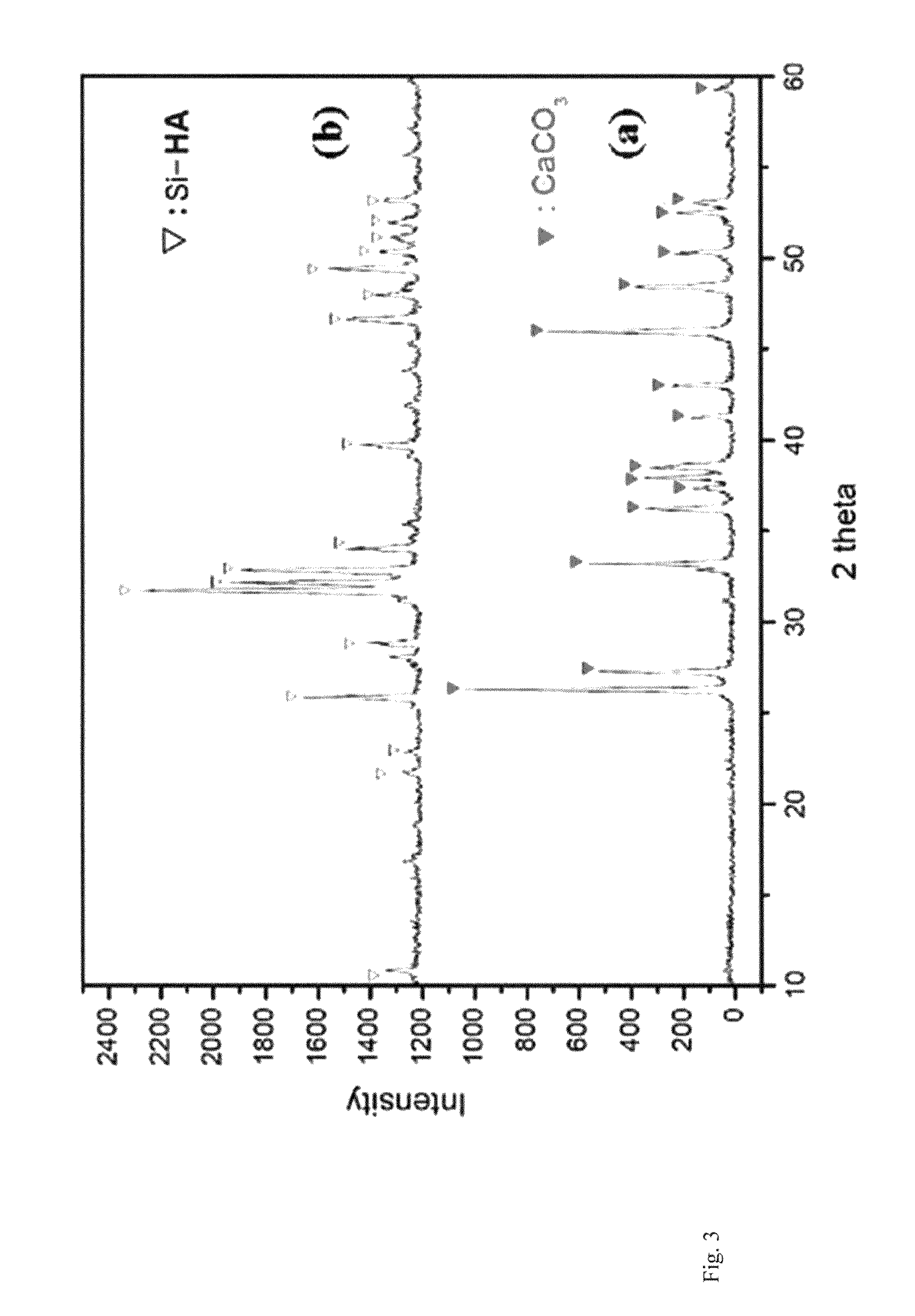Porous composite comprising silicon-substituted hydroxyapatite and ß- tricalcium phosphate, and process for preparing the same