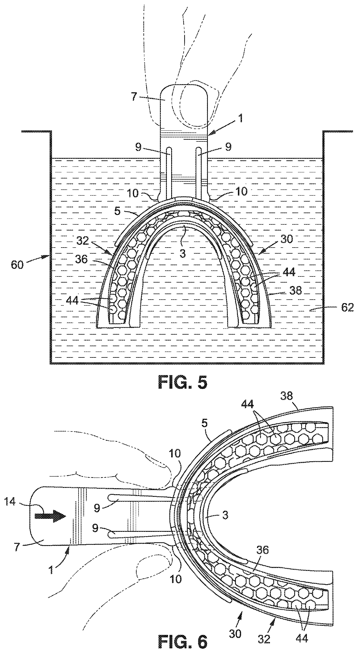Impression tray with integral handle for an oral jaw advancement appliance