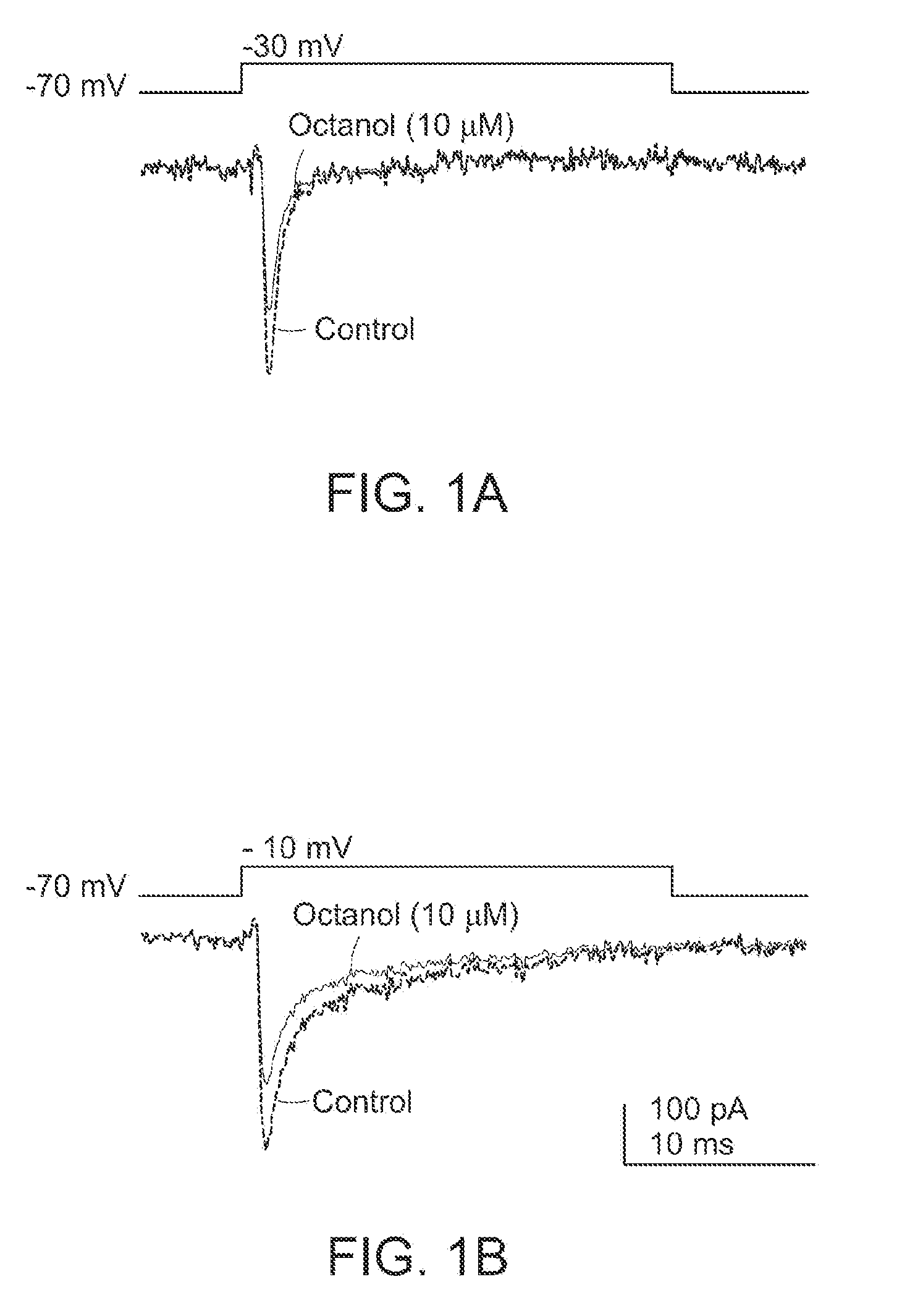 Methods and Compositions for Treating Thalamocortical Dysrhythmia