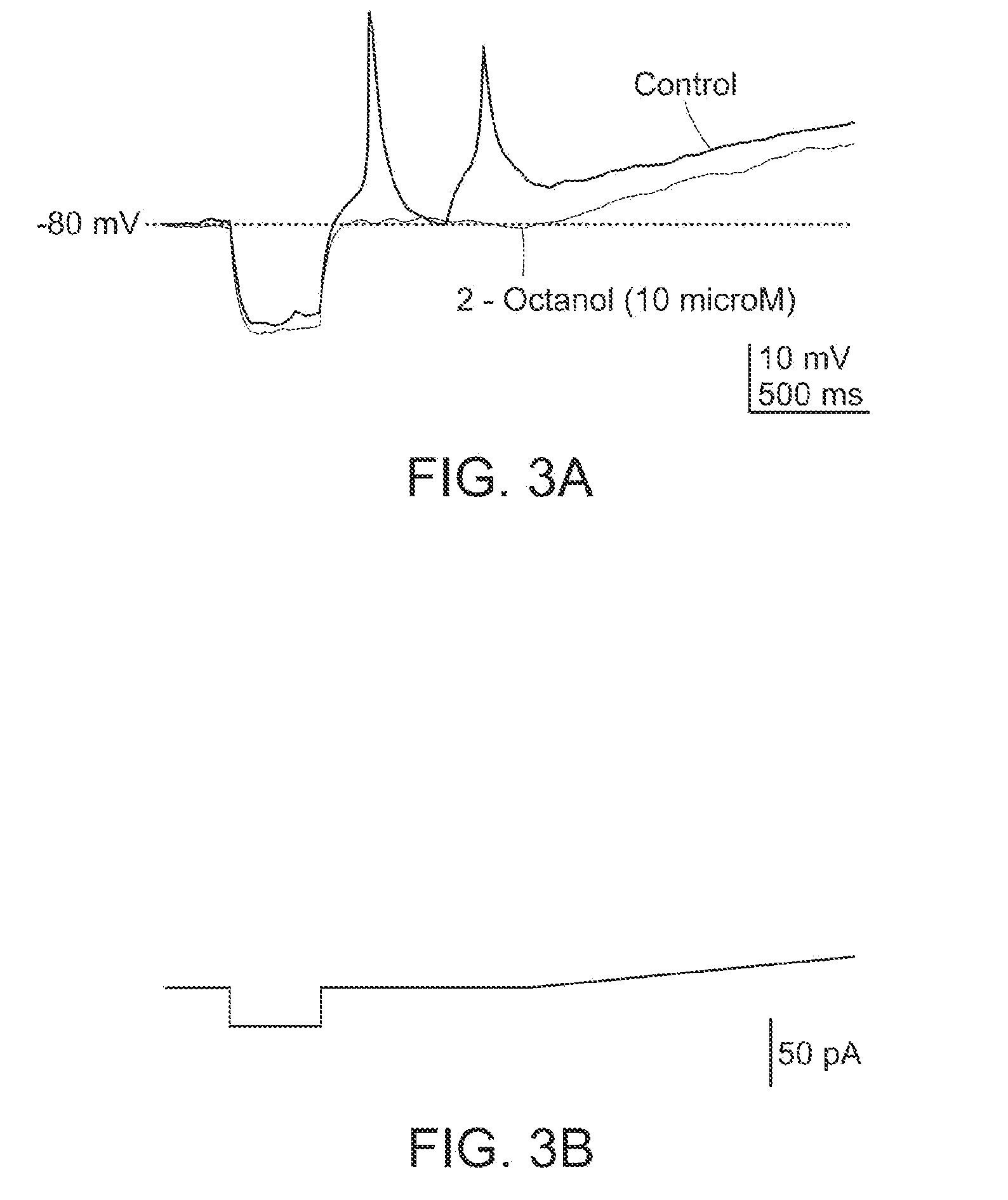 Methods and Compositions for Treating Thalamocortical Dysrhythmia