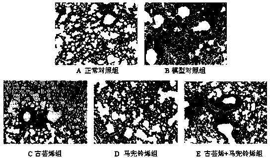 Medicament for treatment of lung diseases and application thereof