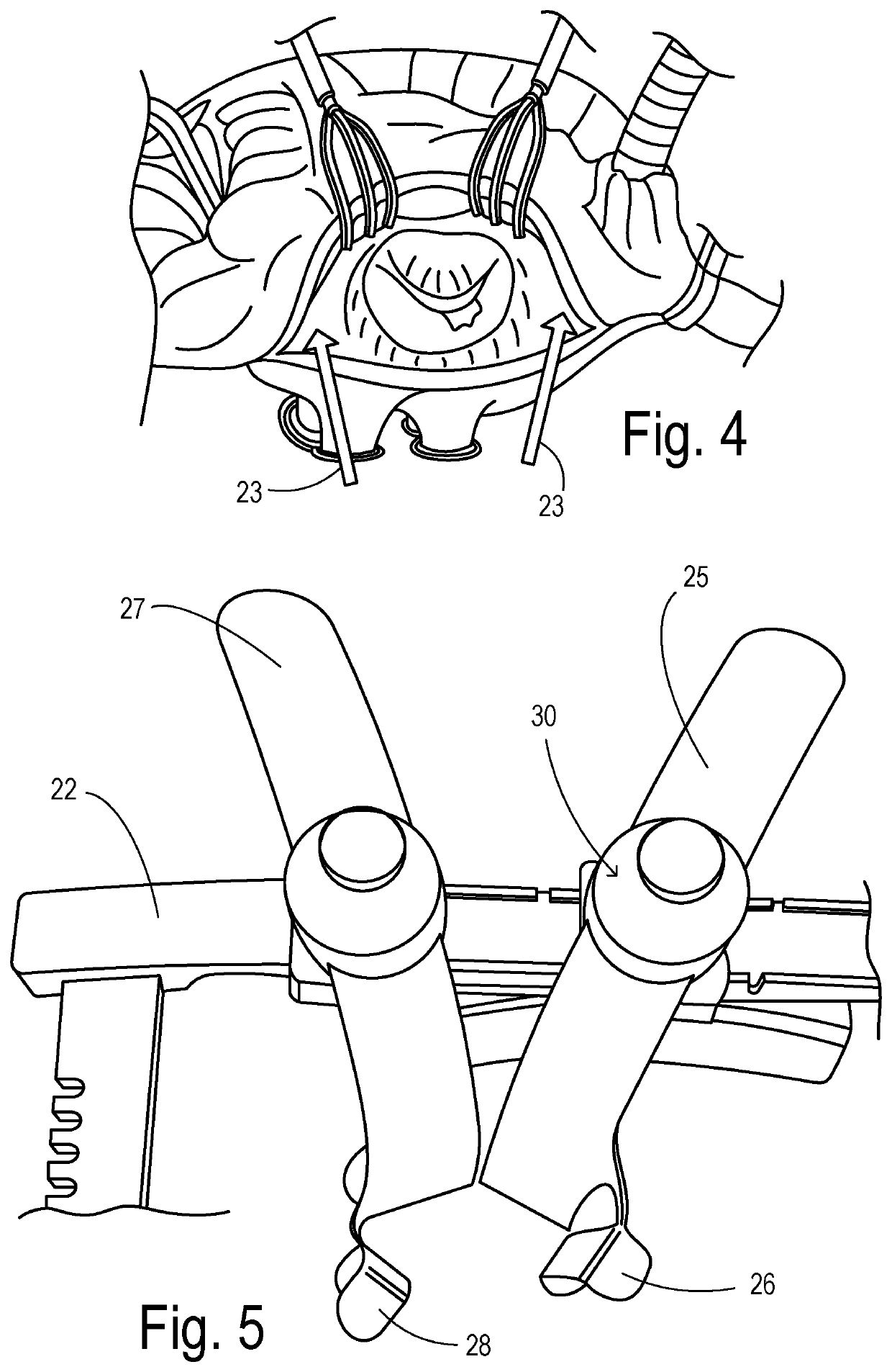 Mitral valve retractor with side malleable retract feature and universal adjuster