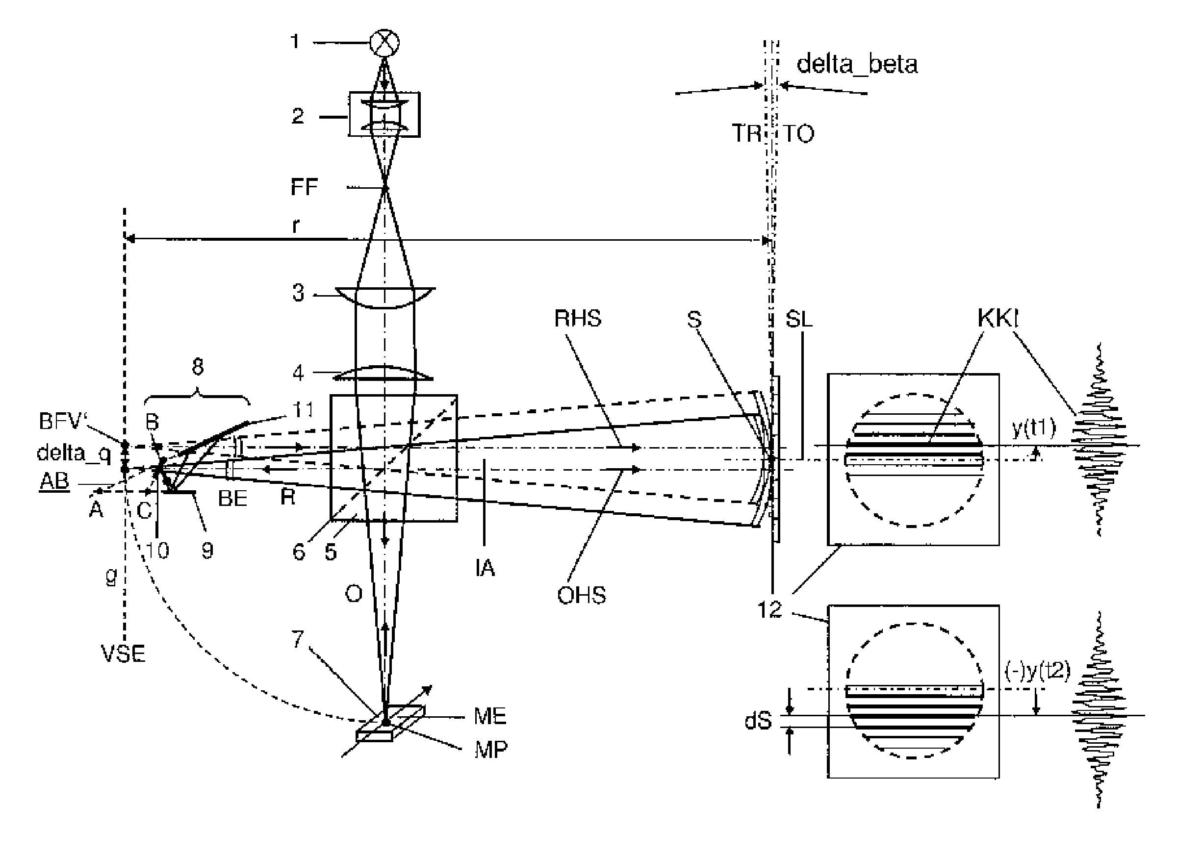 Method and arrangement for robust interferometry for detecting a feature of an object