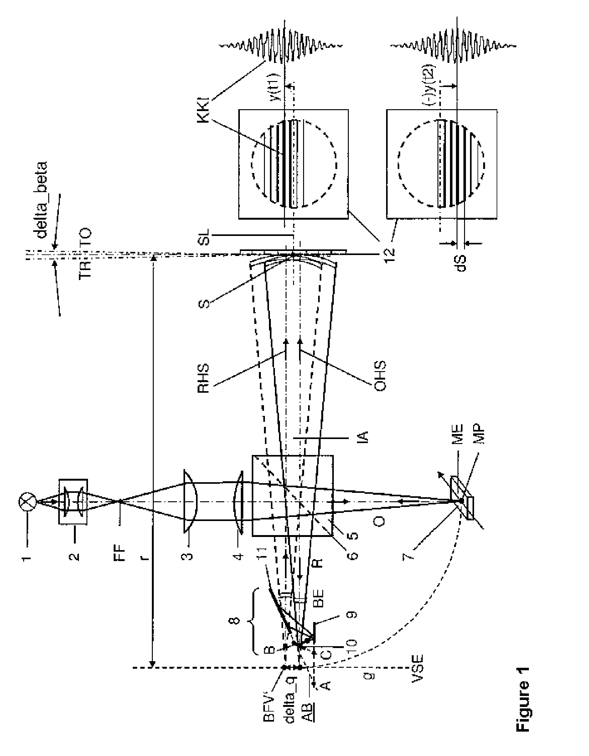 Method and arrangement for robust interferometry for detecting a feature of an object