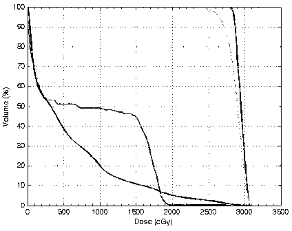 Method for deriving and reestablishing dosage-volume histograms from Pinnacle radiotherapy plan system