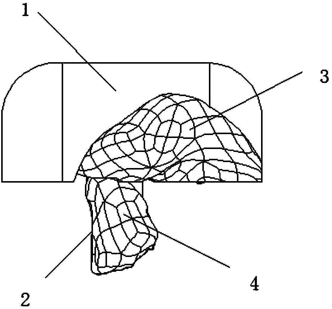 Adelomorphic orthodontic accessory guide board, complete set product, production method and accessory bonding method