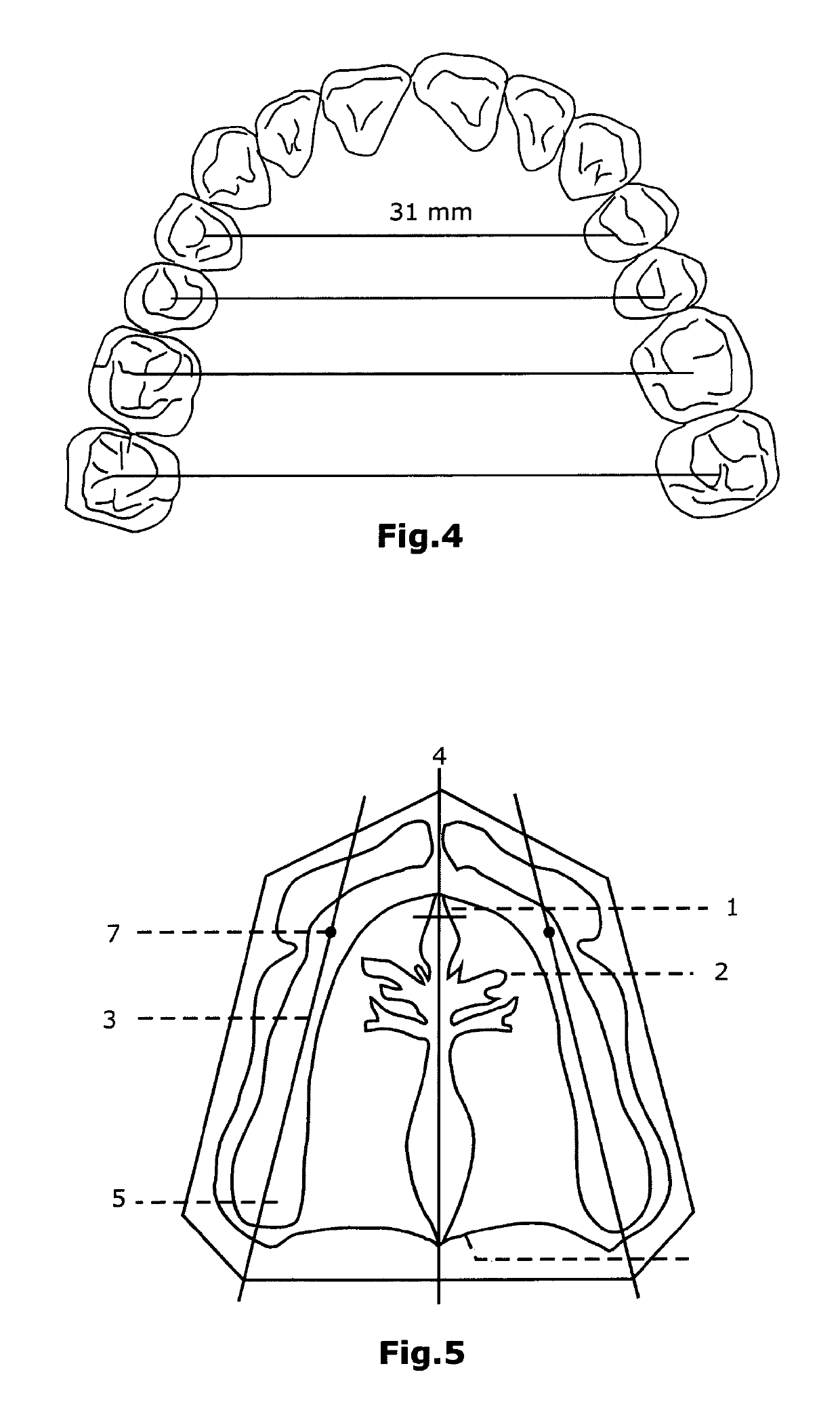 Method for preparing a partial or full dental prosthesis